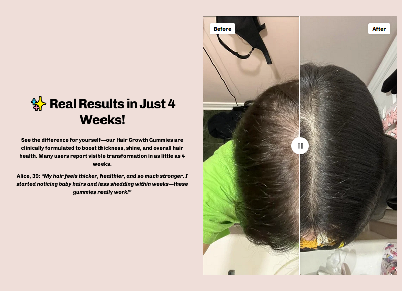 Force Factor Hair Soft Chews with Vitamins for General Daily Use | My Nature Glow